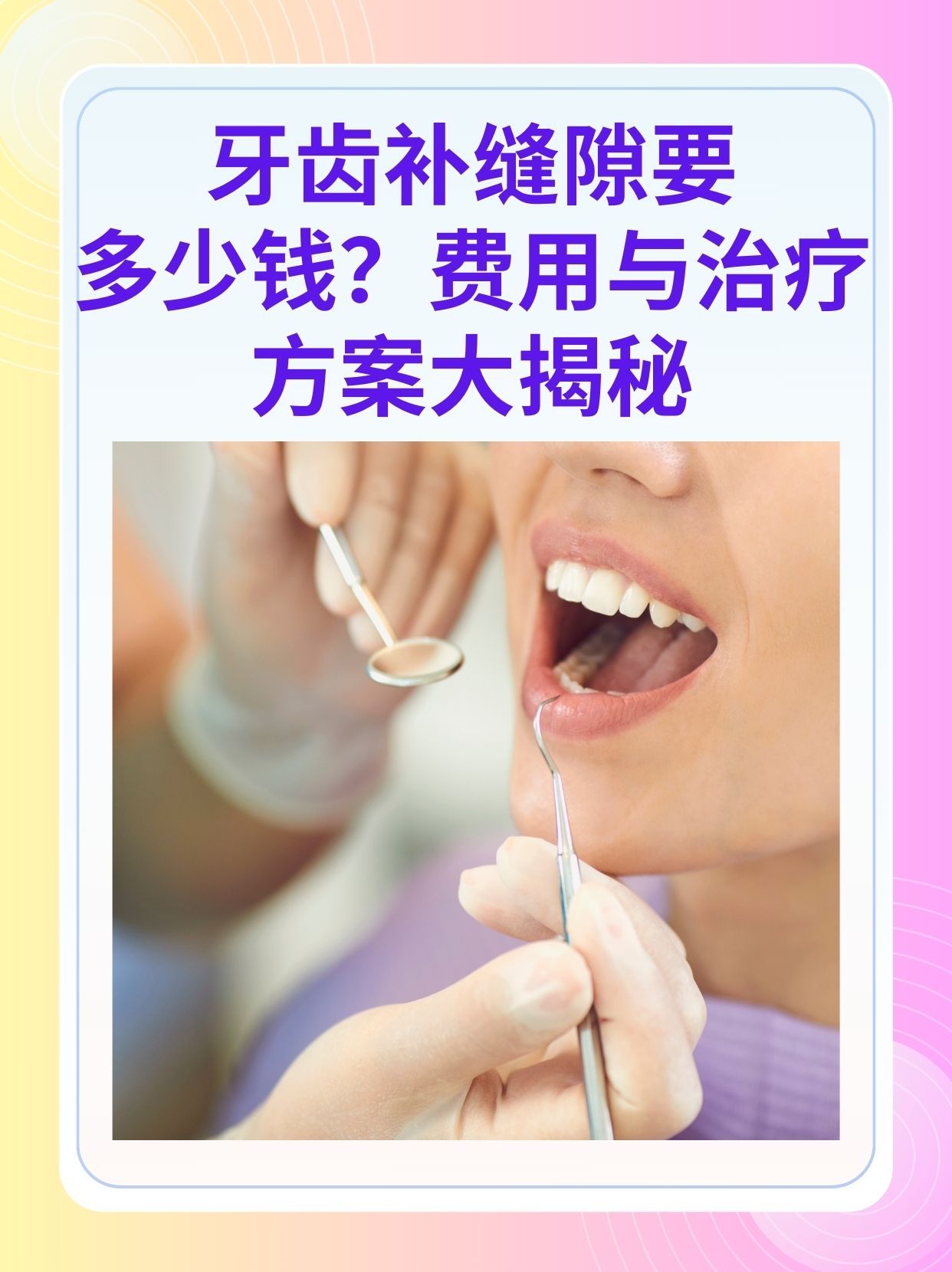 新余补牙医保可以报销吗(补牙医保可以报销吗 哪些可以报销呢)